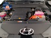 Hyundai Kona 1.6 gdi hev xtech 2wd 141cv dct