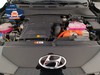 Hyundai Kona 1.6 gdi hev xtech 2wd 141cv dct