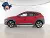 Hyundai Kona 1.0 t-gdi classic 2wd 120cv